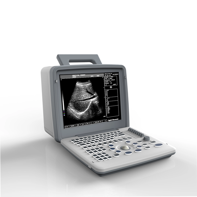 Black White Laptop Hospital Ultrasound Equipment