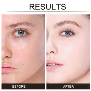 Hydratation Blanc Truffe Sérum Crème Visage Hydratant Nourrir Rétrécir Les Pores Peau Réparatrice Rajeunissement Visage Crème Éclaircissante - Product Image 2