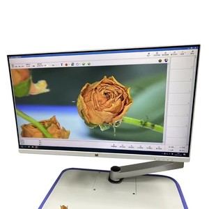 स्त्री रोग विज्ञान के लिए डिजिटल उच्च परिभाषा ट्रॉली कोपोस्कोप के लिए वीडियो कोलोपोस्कोपी उपकरण - Product Image 2