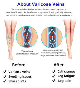 <span class=keywords><strong>Bas</strong></span> <span class=keywords><strong>de</strong></span> compression longueur genou 30-40mmHg <span class=keywords><strong>bas</strong></span> varices équipement médial à domicile - Product Image 6