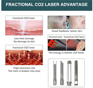 Non-Invasive Anti-Aging Skin Care CO2 Oxygen Micro-current Plastic ABS Face Lift No Needle Beauty Desktop Acne Scar Removal - Product Image 1