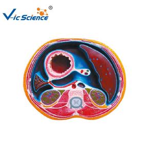 แบบจำลองทางกายวิภาคของวิทยาศาสตร์การแพทย์สำหรับการผ่าตัดช่องท้องแบบจำลองทางกายวิภาคและทางการแพทย์ - Product Image 1