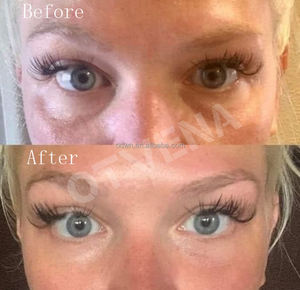 Vente chaude OEM 60 Secondes <span class=keywords><strong>Crème</strong></span> <span class=keywords><strong>Anti</strong></span>-<span class=keywords><strong>Rides</strong></span> Instantanée pour les Yeux avec Effet Visible - Product Image 2