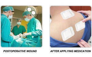 Consommables médicaux jetables du fabricant de Ningbo, ruban adhésif non tissé bordé, pansement chirurgical - Product Image 6