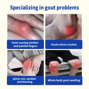 ครีมแก้ปวดข้อ <span class=keywords><strong>นิ้ว</strong></span>มือ <span class=keywords><strong>นิ้ว</strong></span>เท้า ข้ออักเสบ <span class=keywords><strong>ปวด</strong></span>ข้อเข่า <span class=keywords><strong>ปวด</strong></span><span class=keywords><strong>กระดูก</strong></span> นวดบำรุงด้วยวิตามินอี - Product Image 3