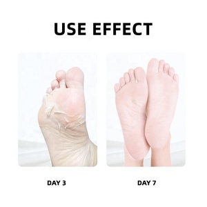 Saloon Tea Tree Spa <span class=keywords><strong>Para</strong></span> Pies <span class=keywords><strong>Pedicure</strong></span> Foot Soak Gel de baño <span class=keywords><strong>Jelly</strong></span> Spa <span class=keywords><strong>Pedicure</strong></span> Salt Scrub Tablets <span class=keywords><strong>Pedicure</strong></span> Care Box <span class=keywords><strong>para</strong></span> Foot Spa - Product Image 3