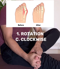 Correcteur de pied Tenicore, correcteur <span class=keywords><strong>d</strong></span>'hallux valgus, <span class=keywords><strong>sandales</strong></span> correctrices <span class=keywords><strong>d</strong></span>'hallux valgus, coussin en gel, chaussettes de pédicure, équipement de soins de santé - Product Image 5