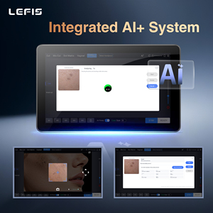 LEFIS Dispositivo <span class=keywords><strong>Laser</strong></span> CO2 Frazionato Multifunzionale ad Alte Prestazioni per Cura della Pelle, Uso Domestico e Professionale - Product Image 5