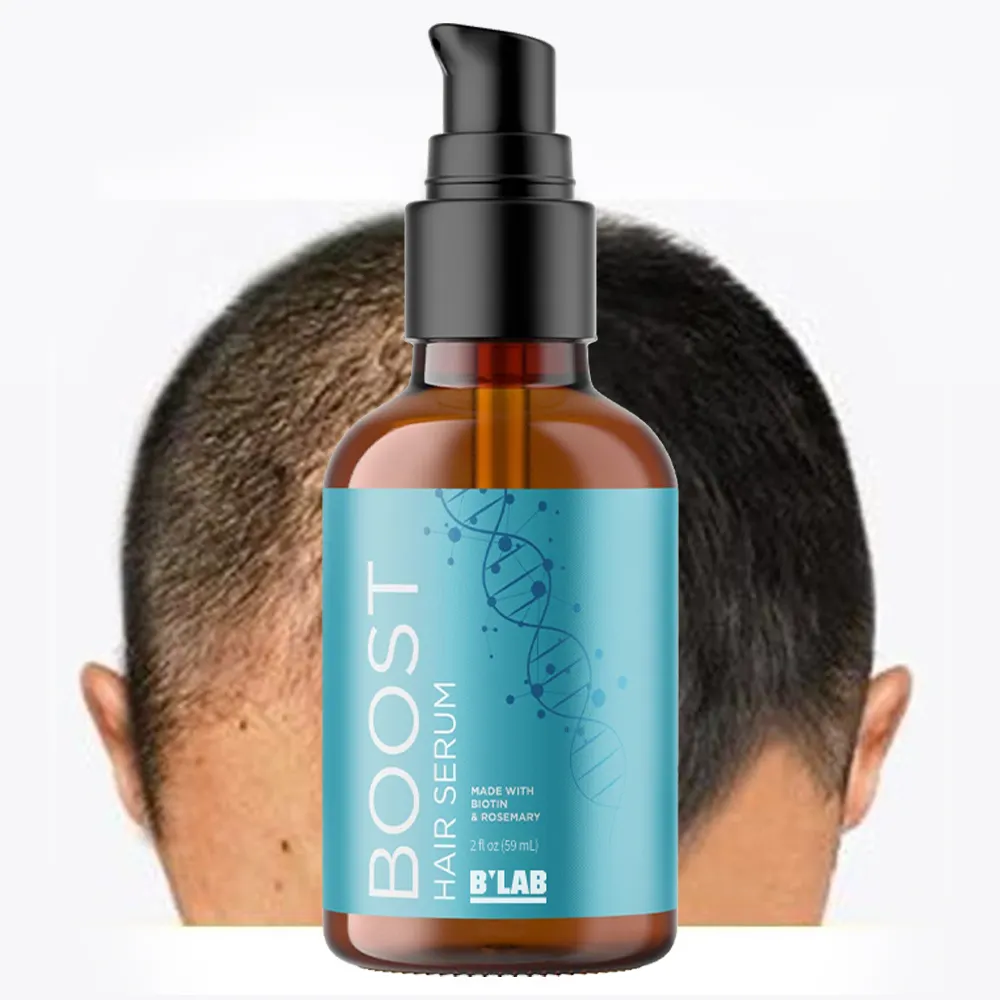 Eigenmarke reines natürliches Ätherisches Öl für Haardichte biologischer Rosemary-Biotin-Haarwachstumsöl-Serum schnell-Haarwachstumsprodukte
