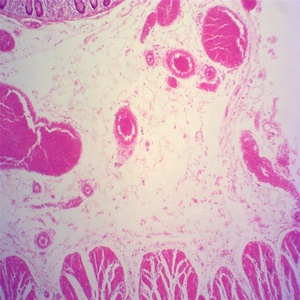 Histologie von menschlichen eierstock tissue rutschen - Product Image 6