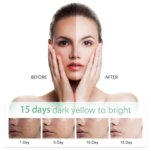 Nettoyant Visage Bio Éclaircissant Anti-Taches Crème Nettoyante Profonde pour Peaux Sensibles Adultes - Product Image 4