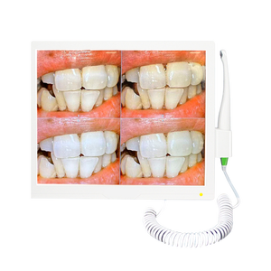 Système de caméra intra-orale haute résolution avec objectif <span class=keywords><strong>macro</strong></span> pour usage <span class=keywords><strong>dentaire</strong></span> et moniteur PC - Product Image 1