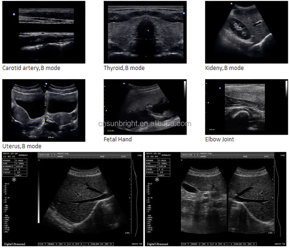 Sistem Diagnostik Ultrasound Portabel B Portabel Warna Laptop Tiongkok