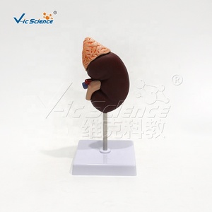 Modelo de Disección Renal de PVC, Tamaño <span class=keywords><strong>Natural</strong></span>, con Calices y Ureter, para Laboratorio de Habilidades de Enfermería, con Certificaciones CE, ISO, ROHS y CNAS - Product Image 6