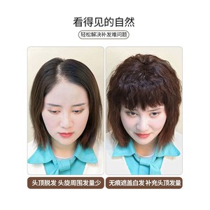 Corn Perm Hair Replacement Block For Women <b>Cover</b> Gray Hair Top toupee High <b>Temperature</b> Wire Real Hair Extension - Product Image 3