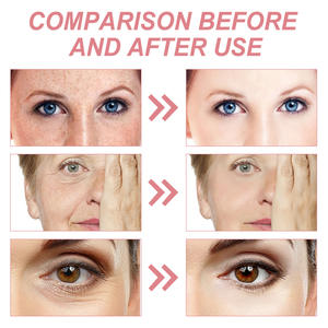 Crème raffermissante 5 en 1 Réduit les rides et les taches Améliore la matité Hydrate Hydrate et lifte la crème pour le visage - Product Image 5