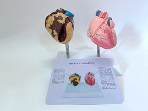 Modelo <span class=keywords><strong>de</strong></span> Anatomía <span class=keywords><strong>de</strong></span> Órganos Humanos para Comparar Corazones Patológicos y Sanos, <span class=keywords><strong>de</strong></span> Plástico, para Educación Médica, Yulin YL2-30079 - Product Image 2