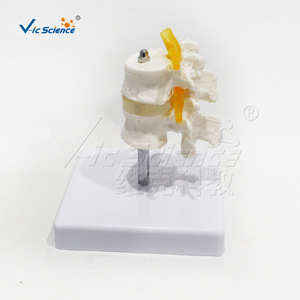 Modelo de vértebra humana de dos segmentos, material de PVC de alta precisión, estructura precisa, para demostración de patología en universidades - Product Image 4