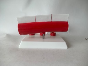 Modelo de Progresión de la Aterosclerosis con Secciones de 3 Etapas para la Enseñanza de Cardiología - Product Image 5