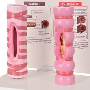 Medizinisches Lehrmodell: Vergleich von Normaler und Asthmatischer Luftröhre für Atemwegsunterricht - Product Image 3
