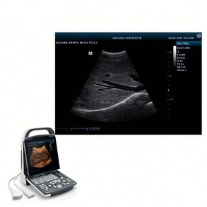 Instrumento de ultrasonido médico DP20 2D Color Doppler Ultrasonido Uso humano Digital <span class=keywords><strong>Mindray</strong></span> BW Ultrasonido - Product Image 2