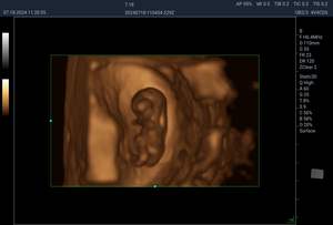 Draagbaar 3d4d Verloskundig Echografiesysteem Met Hartscreening-Volumetrische Imagin Voor Prenatale Diagnose Foetale Echocardiografie - Product Image 6