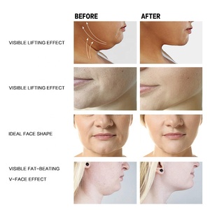 V crème raffermissante pour le visage, crème <span class=keywords><strong>amincissante</strong></span> pour le visage, Lifting et raffermissement du visage, Double <span class=keywords><strong>menton</strong></span> - Product Image 3
