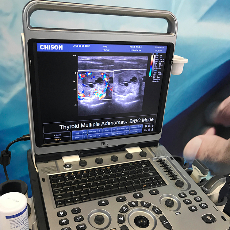 Fábrica Chison Ebit 50 Equipos De Ultrasonido Médico 3D 4D Sistema de Doppler de Color Con Sonda Convexa