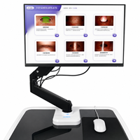 Simulador de Histeroscopia Virtual con Force Feedback, Sistema de Entrenamiento en Ginecología con IA para Práctica de Habilidades de Cirugía Histeroscópica en Residentes
