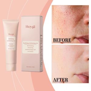 Gel <span class=keywords><strong>Facial</strong></span> de <span class=keywords><strong>Limpieza</strong></span> Profunda Orgánico Hoygi, Blanqueador y Control de Grasa, Exfoliante, Hidratante Natural para el Cuidado de la Piel - Product Image 3