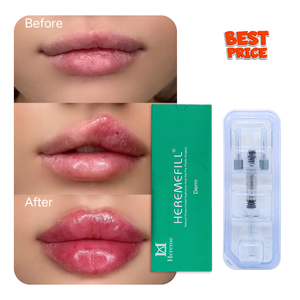 Hereme Lip Filler 2ml, Inyección <span class=keywords><strong>de</strong></span> Ácido Hialurónico para Aumentar el Volumen <span class=keywords><strong>de</strong></span> los <span class=keywords><strong>Labios</strong></span> y Realzar el Color Rojo, <span class=keywords><strong>Precio</strong></span> al por Mayor <span class=keywords><strong>con</strong></span> Certificación ISO y CE - Product Image 4