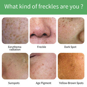 Forte élimination blanchissante tache de rousseur crème pour le <span class=keywords><strong>visage</strong></span> soins de la peau marque privée dissolvant correcteur de taches sombres pour le corps et le <span class=keywords><strong>visage</strong></span> - Product Image 3