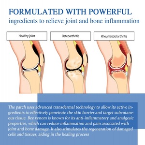 สมุนไพรบรรเทาอาการปวดข้อเข่ากล้ามเนื้อคอเอวลดอาการปวดกล้ามเนื้อลดอาการปวดกล้ามเนื้อลดอาการปวดแบบทันทีปลอกเอ็นไซนิวส์สำหรับใช้ในร่างกาย - Product Image 4