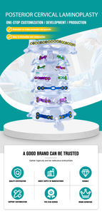 Sistema de Laminoplastia Cervical: Implantes de Titânio para Coluna, Placa Cervical, Parafuso, Placa de Porta Aberta, Implante Ortopédico e Instrumentos para Implante - Product Image 5