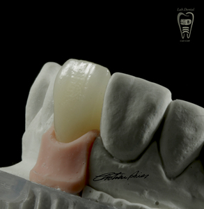 Kit de base en céramique de zircone BAOT PFZ, matériel de laboratoire <span class=keywords><strong>dentaire</strong></span> esthétique, zircone <span class=keywords><strong>dentaire</strong></span>, poudre de porcelaine <span class=keywords><strong>dentaire</strong></span> - Product Image 3