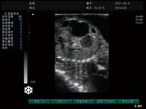 MC1000Vet mesin dokter hewan pemindai <span class=keywords><strong>Ultrasound</strong></span> Laptop 15 inci paling terjangkau untuk kuda, sapi, swine dan anjing - Product Image 3