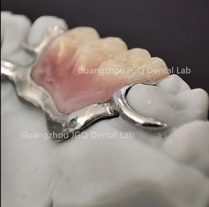 Marco dental de titanio de último diseño con <span class=keywords><strong>dentaduras</strong></span> acrílicas Precio perfecto asequible - Product Image 6
