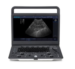 Escáner de Ultrasonido Veterinario <span class=keywords><strong>Sonoscape</strong></span> E1v <span class=keywords><strong>Vet</strong></span> 3D 2D Blanco y Negro Portátil Veterinario Ultrasonido BW - Product Image 6