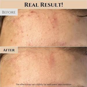 Cuidado DE LA PIEL coreana Poro aceitoso Conjuntos de belleza Honey Glow Mask Ground Rice Toner Revive Eye Bag Removal Cream Glow Deep Serum - Product Image 6