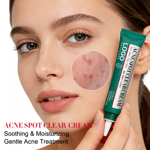 Crème anti-acné douce de qualité supérieure OEM, combat les éruptions cutanées, apaise les rougeurs, hydrate en profondeur, soin d'urgence, atténue les marques d'acné - Product Image 1