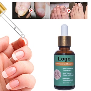 Logotipo personalizado/etiqueta privada 30ML Solución de aceite de reparación de <span class=keywords><strong>uñas</strong></span> Renovación y tratamiento de infecciones para hongos <span class=keywords><strong>en</strong></span> <span class=keywords><strong>las</strong></span> <span class=keywords><strong>uñas</strong></span> - Product Image 2