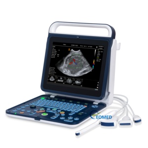 MSK Máquina de <span class=keywords><strong>Ultrasonido</strong></span> <span class=keywords><strong>Doppler</strong></span> a Color Digital para Veterinaria <span class=keywords><strong>Vascular</strong></span> Cardíaca Humana Ultra-portátil <span class=keywords><strong>Ultrasonido</strong></span> Ultra asequible CU25 - Product Image 1