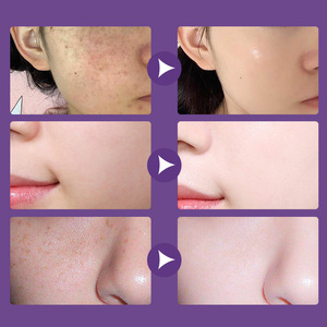 เซรั่มบำรุงผิวหน้า แอมพูลไวท์เทนนิ่ง บราイトเทนนิ่ง เอสเซนส์บำรุงผิวหน้า แอมพูลเนื้อนุ่ม ลดเลือนริ้วรอย - Product Image 4