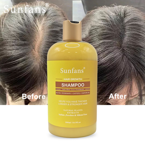 Huile de <span class=keywords><strong>ricin</strong></span> au romarin biologique naturelle Anti-chute de cheveux Formule concentrée hydratante et nourrissante Shampooing sans sulfate pour renforcer - Product Image 6