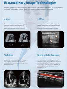 Sonoscape P11Elite <span class=keywords><strong>4D</strong></span>/5D Trolley Machine à ultrasons Doppler couleur avec sonde convexe électrique pour veines bébé abdomen - Product Image 3