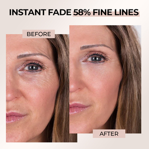Crème anti-âge pour le visage de marque privée femmes Pro Xyline bifida <span class=keywords><strong>perment</strong></span> lysat collagène niacinamide infusé réparation des rides - Product Image 5