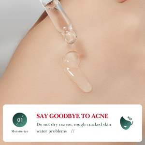 Suero SADOER con Extracto de Ácido Salicílico de Rosa, Tratamiento Original para el Acné, Eliminador de Puntos Negros, Cuidado de la Piel - Product Image 5