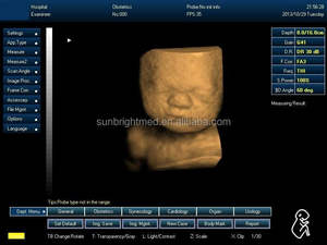 <span class=keywords><strong>Precio</strong></span> barato Sistema ultrasónico veterinario Sistema de ultrasonido Doppler color veterinario - Product Image 5