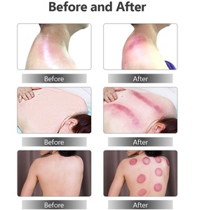 Appareil de massage corporel 2 <span class=keywords><strong>en</strong></span> 1 pour le remodelage, le drainage lymphatique, la thérapie des fascias et le raffermissement de la peau - Product Image 6