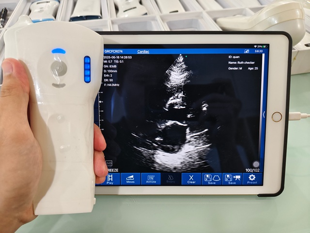DMU75 High Quality and Hot Selling Handheld 3 In 1 192 Elements 64 Channels Color doppler Wireless Probe for Hospital and Clinic